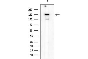 Western blot analysis of lysates from HepG2 cells(LPS 4h treatment), using NOS3 Mouse Monoclonal Antibody at 1/1000 dilution.