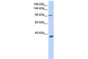 Image no. 1 for anti-Endothelial PAS Domain Protein 1 (EPAS1) (AA 360-409) antibody (ABIN6742258) (EPAS1 antibody  (AA 360-409))