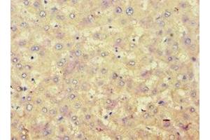 Immunohistochemistry of paraffin-embedded human liver tissue using ABIN7142945 at dilution of 1:100 (ACAT1 antibody  (AA 1-145))