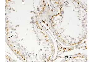 Immunoperoxidase of monoclonal antibody to IL13 on formalin-fixed paraffin-embedded human testis. (IL-13 antibody)
