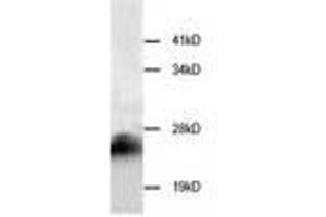 Image no. 1 for anti-Cystatin B (Stefin B) (CSTB) antibody (ABIN791546) (CSTB antibody)