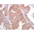 anti-Partner and Localizer of BRCA2 (PALB2) (AA 1101-1186) antibody