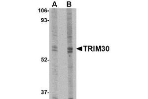 Image no. 1 for anti-Tripartite Motif Containing 30 (Trim30) (N-Term) antibody (ABIN342696)