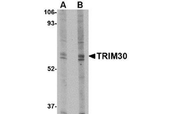 TRIM30 Antikörper  (N-Term)