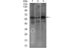 Western blot analysis using FCER1A mouse mAb against SW620 (1), A549 (2), and A431 (3) cell lysate.