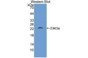 Western blot analysis of the recombinant protein. (KIT antibody)