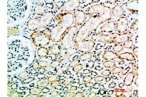 Immunohistochemical analysis of paraffin-embedded human-kidney, antibody was diluted at 1:200 (Angiotensin I Converting Enzyme 1 antibody  (AA 41-90))