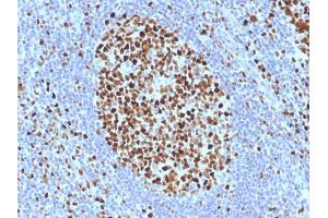 Formalin-fixed, paraffin-embedded human Tonsil stained with MCM7 Monoclonal Antibody (SPM379). (MCM7 antibody)