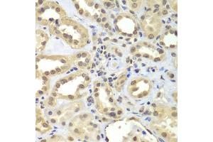 Immunohistochemistry of paraffin-embedded human kidney using SUPT20H antibody (ABIN5975125) at dilution of 1/100 (40x lens). (FAM48A/P38IP antibody)