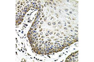 Immunohistochemistry of paraffin-embedded human esophagus using SDC2 antibody (ABIN3022587, ABIN3022588, ABIN3022589 and ABIN6218928) at dilution of 1:100 (40x lens). (Syndecan 2 antibody  (AA 19-144))