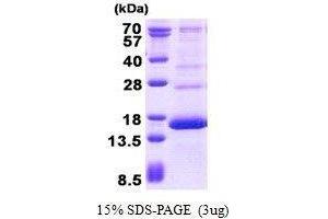 Figure annotation denotes ug of protein loaded and % gel used. (HBG2 Protein)