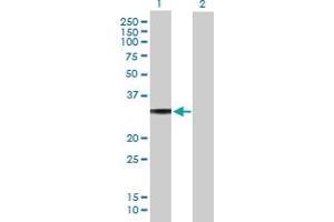 Western Blot analysis of GNAO1 expression in transfected 293T cell line by GNAO1 MaxPab polyclonal antibody. (GNAO1 antibody  (AA 1-302))