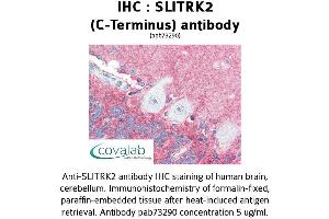 Image no. 1 for anti-SLIT and NTRK-Like Family, Member 2 (SLITRK2) (C-Term) antibody (ABIN1739438)