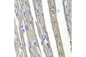 Immunohistochemistry of paraffin-embedded rat heart using C3 antibody (ABIN6131144, ABIN6136723, ABIN6136724 and ABIN6217618) at dilution of 1:100 (40x lens). (AKR1C3 antibody  (AA 1-323))