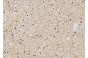 ABIN6268934 at 1/100 staining Human brain tissue by IHC-P. (FOXP3 antibody  (C-Term))
