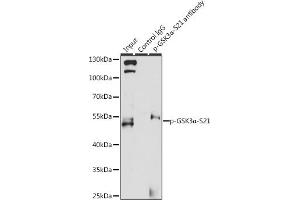 Immunoprecipitation analysis of 200 μg extracts of 293T cells, using 3 μg Phospho-GSK3α-S21 pAb (ABIN6135231, ABIN6136096, ABIN6136097 and ABIN6225606). (GSK3 alpha antibody  (pSer21))