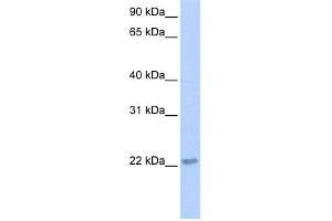 WB Suggested Anti-TCEAL2 Antibody Titration:  0. (TCEAL2 antibody  (N-Term))