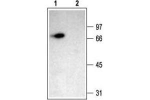 Western blot analysis of rat brain membranes: - 1. (ACCN1 antibody  (Intracellular))
