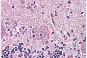 Human Brain, Cerebellum (formalin-fixed, paraffin-embedded) stained with NTSR2 antibody ABIN399994 at 10 ug/ml followed by biotinylated goat anti-rabbit IgG secondary antibody ABIN481713, alkaline phosphatase-streptavidin and chromogen. (NTSR2 antibody  (Internal Region))