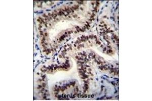 HNRNPCL1 Antibody (C-term) (ABIN655435 and ABIN2844970) immunohistochemistry analysis in formalin fixed and paraffin embedded human uterus tissue followed by peroxidase conjugation of the secondary antibody and DAB staining. (HNRNPCL1 antibody  (C-Term))