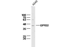 Lane 1: A549 lysates probed with Anti –GPR52 Polyclonal Antibody, Unconjugated (bs-13539R) at 1:300 overnight at 4˚C. (GPR52 antibody  (AA 151-250))