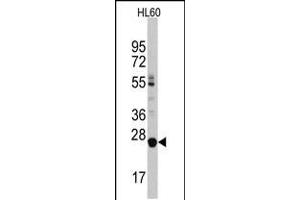 Western blot analysis of LIN28B Antibody in HL60 cell line lysates (35ug/lane) (LIN28B antibody  (C-Term))