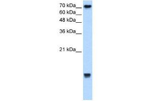 WB Suggested Anti-UBE2N  Antibody Titration: 2. (UBE2N antibody  (Middle Region))