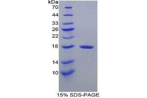 SDS-PAGE (SDS) image for Transthyretin (TTR) (AA 23-147) protein (His tag) (ABIN2127075)