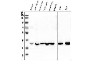 Western blot analysis of FOSB using anti-FOSB antibody (ABIN3042399).