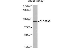 Western blot analysis of extracts of mouse kidney, using SLC22A2 antibody (ABIN6291468) at 1:1000 dilution.