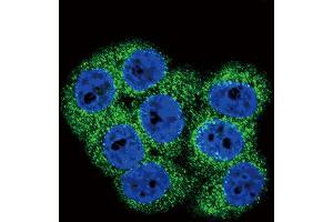 Immunofluorescence (IF) image for anti-Discoidin Domain Receptor tyrosine Kinase 1 (DDR1) antibody (ABIN3003119) (DDR1 antibody)