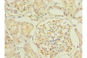 Immunohistochemistry of paraffin-embedded human kidney tissue using ABIN7170183 at dilution of 1:100 (SLC25A33 antibody  (AA 66-120))