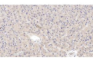 Immunohistochemistry (IHC) image for anti-Wingless-Type MMTV Integration Site Family, Member 4 (WNT4) (AA 26-351) antibody (ABIN7427258)