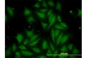 Immunofluorescence of monoclonal antibody to TIMP2 on HeLa cell. (TIMP2 antibody  (AA 27-220))