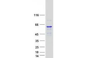 Validation with Western Blot (KATNAL1 Protein (Transcript Variant 2) (Myc-DYKDDDDK Tag))