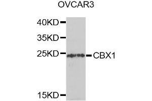 Western blot analysis of extracts of OVCAR-3 cells, using CBX1 antibody (ABIN5971253) at 1/1000 dilution.