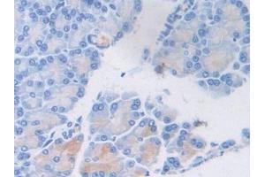 Detection of vWF in Rat Pancreas Tissue using Polyclonal Antibody to Von Willebrand Factor (vWF) (VWF antibody  (AA 269-367))