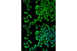 Immunofluorescence (IF) image for anti-WNK Lysine Deficient Protein Kinase 1 (WNK1) antibody (ABIN1875447) (WNK1 antibody)