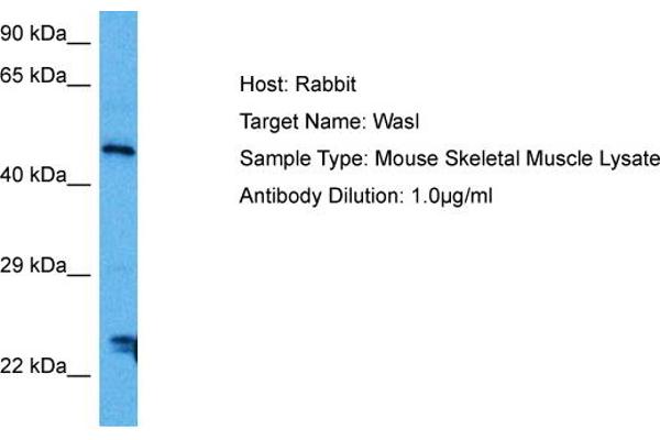 Neural Wiskott-Aldrich syndrome protein (WASL) (Middle Region) antibody