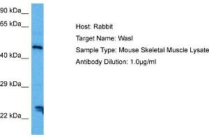 Host: Mouse Target Name: WASL Sample Tissue: Mouse Skeletal Muscle Antibody Dilution: 1ug/ml (Neural Wiskott-Aldrich syndrome protein (WASL) (Middle Region) antibody)