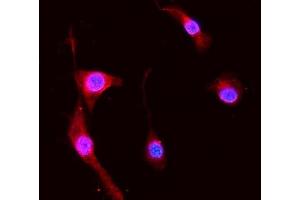 IF analysis of S100A8 using anti-S100A8 antibody (ABIN3042481).