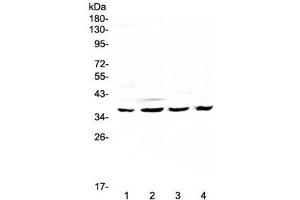 Western blot testing of human 1) HeLa, 2) SGC-7901, 3) K562 and 4) mouse SP2/0 lysate with Cdk6 antibody at 0. (CDK6 antibody  (AA 1-326))