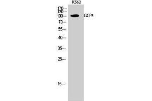 Western Blotting (WB) image for anti-Folate Hydrolase 1B (FOLH1B) (Internal Region) antibody (ABIN3184769)
