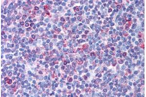 Tonsil (TRIM13 antibody  (AA 165-214))