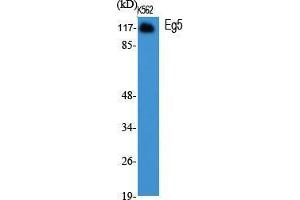 Western Blot (WB) analysis of specific cells using Eg5 Polyclonal Antibody. (KIF11 antibody  (Ser711))