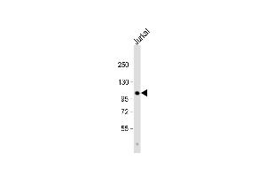 Anti-Parg Antibody (C-term) at 1:1000 dilution + Jurkat whole cell lysate Lysates/proteins at 20 μg per lane. (PARG antibody  (C-Term))
