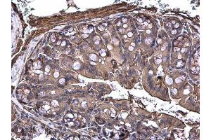 IHC-P Image MAP3K8 antibody [N3C3] detects MAP3K8 protein at cytoplasm on mouse colon by immunohistochemical analysis. (MAP3K8 antibody)