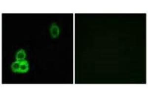 Immunofluorescence analysis of MCF-7 cells, using CELSR1 antibody. (CELSR1 antibody)
