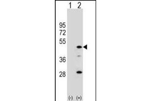 Western blot analysis of DAC (arrow) using rabbit polyclonal DAC Antibody (C-term) (ABIN390780 and ABIN2841034).