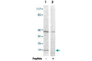 Western blot analysis of extracts from A-549 cells, using HIST1H2BH polyclonal antibody . (HIST1H2BH antibody)